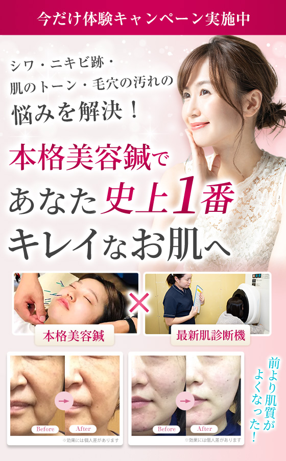 美容鍼