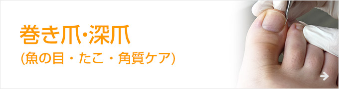巻き爪