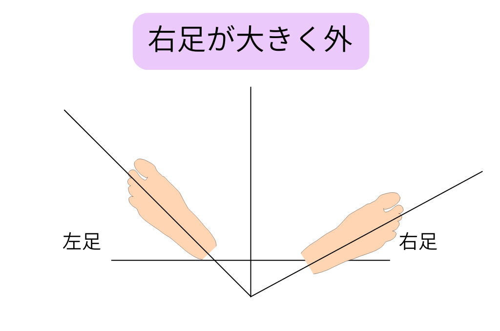 右足が大きく外