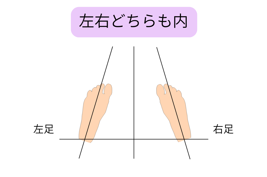 左右どちらも内